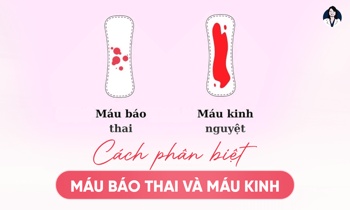 Phân Biệt Máu Báo Thai Và Máu Kinh