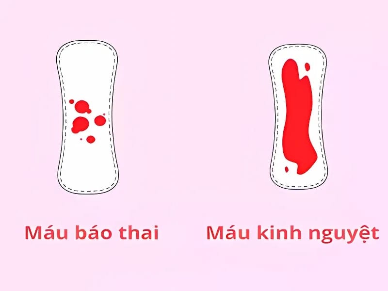 Phân Biệt Máu Báo Thai Và Máu Kinh